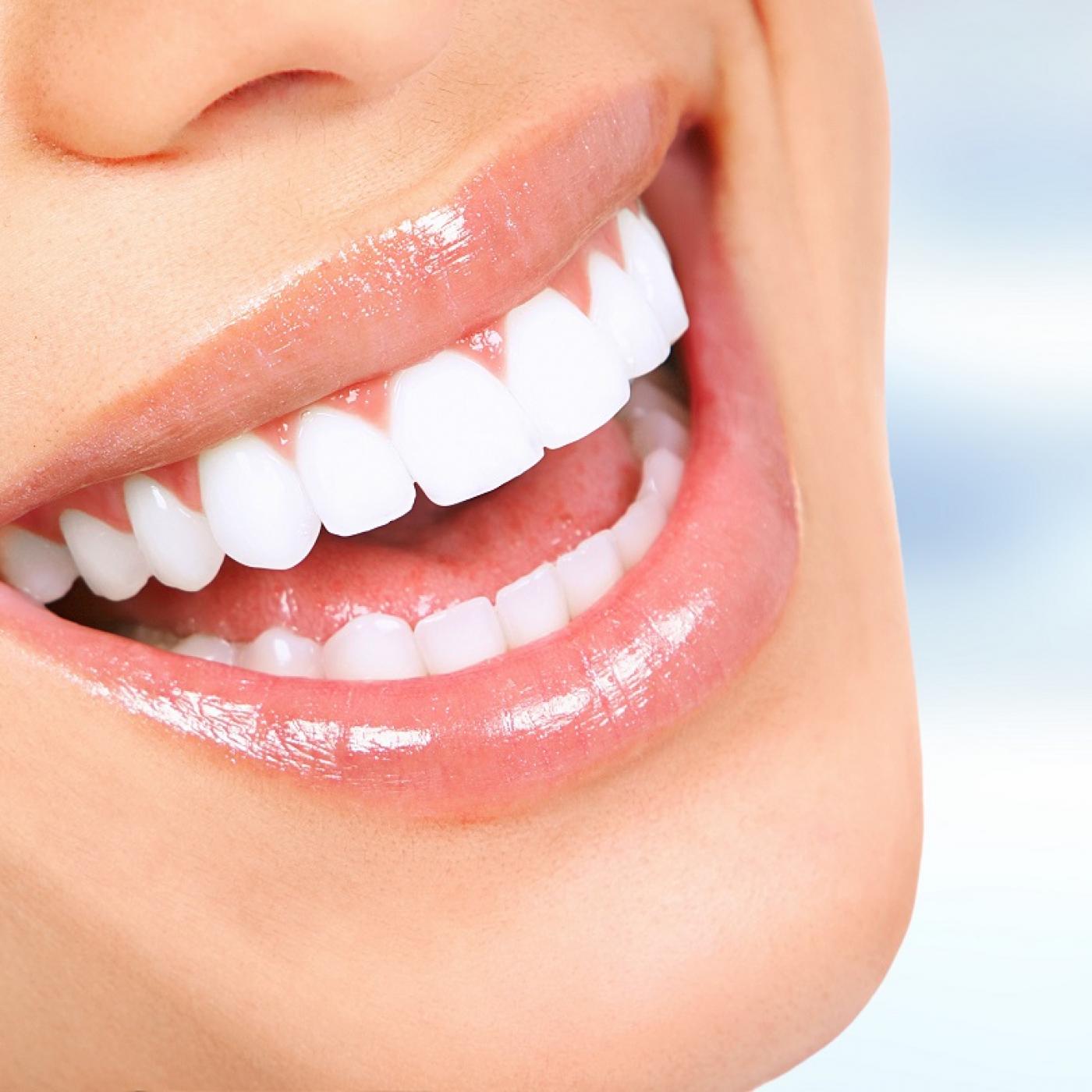 Le Journal des Bonnes Nouvelles : Comment avoir les dents plus blanches ?